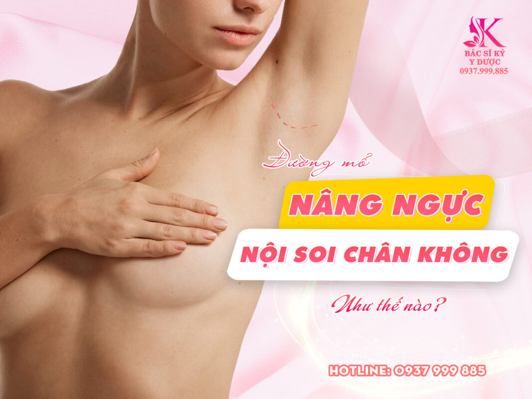 Đường mổ nâng ngực nội soi như thế nào