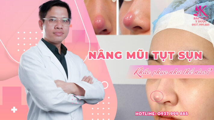 Nâng mũi bị tụt sụn do đâu