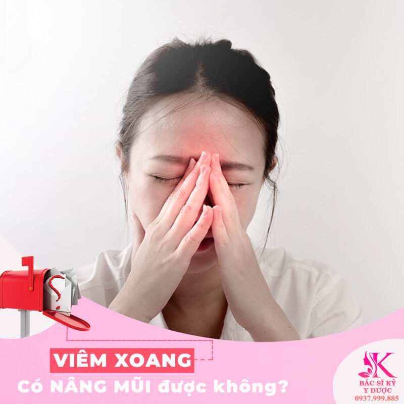 Viêm xoang có được nâng mũi?