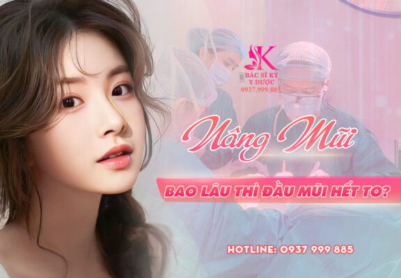 nâng mũi bao lâu thì đầu mũi hết to