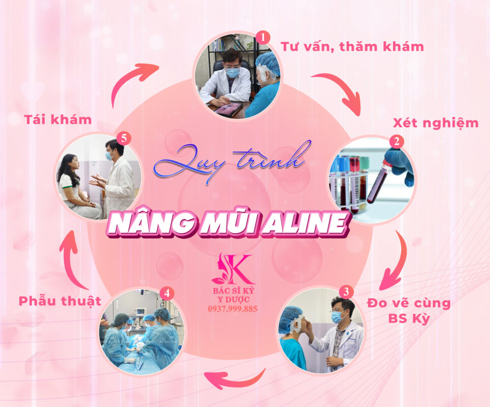 Quy trình nâng mũi Aline