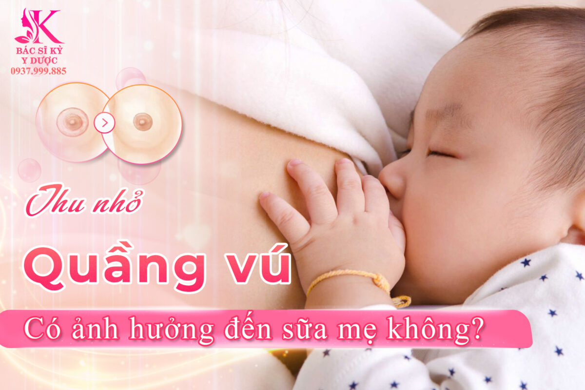 thu nhỏ quầng vú có ảnh hưởng đến sữa mẹ không