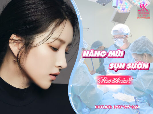 nâng mũi sụn sườn toàn phần