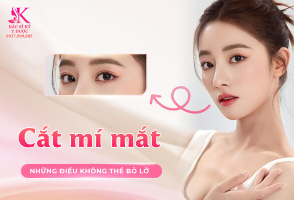 Phẫu thuật cắt mí trên