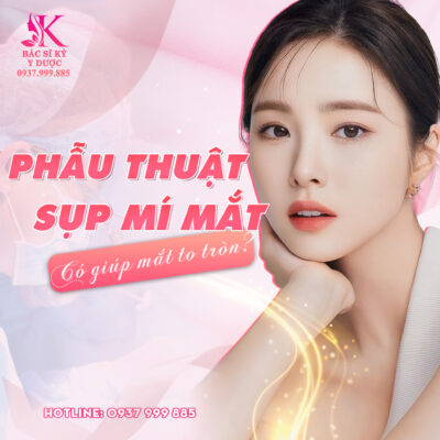 Phẫu thuật sụp mí mắt bẩm sinh có giúp mắt to tròn