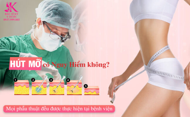 hút mỡ bụng có nguy hiểm không