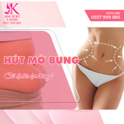 Hút mỡ bụng có bị béo lại không