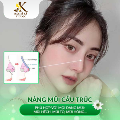 Nâng mũi cấu trúc