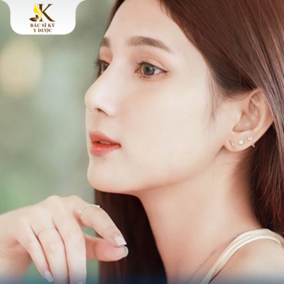 Nâng mũi sụn tai