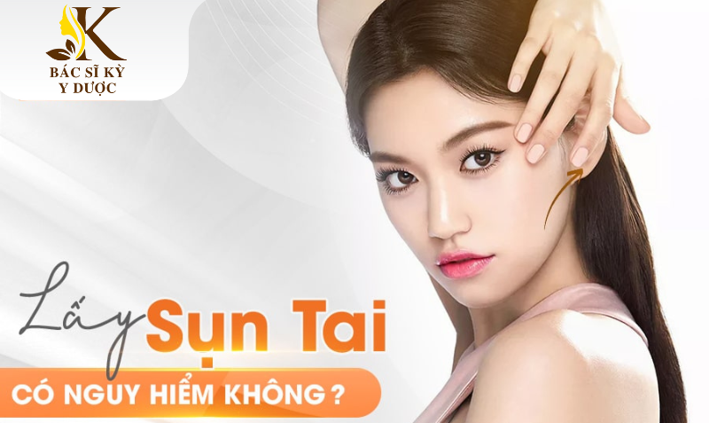 Nâng mũi bằng sụn tai có an toàn không