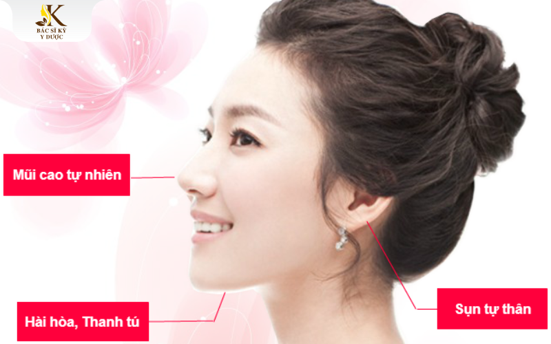 Nâng mũi bằng sụn tai