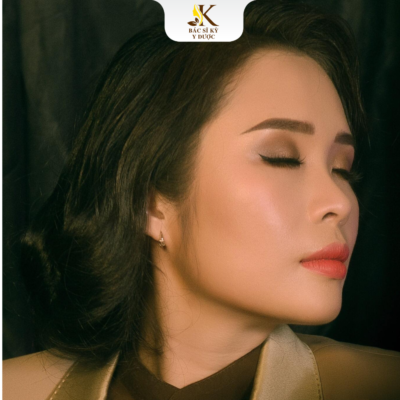 nâng mũi chỉ collagen bao lâu thì hết sưng