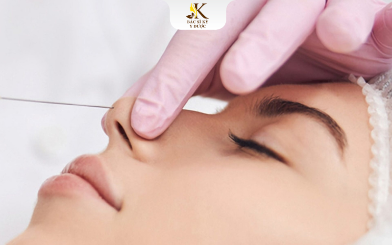 Đối tượng nâng mũi chỉ