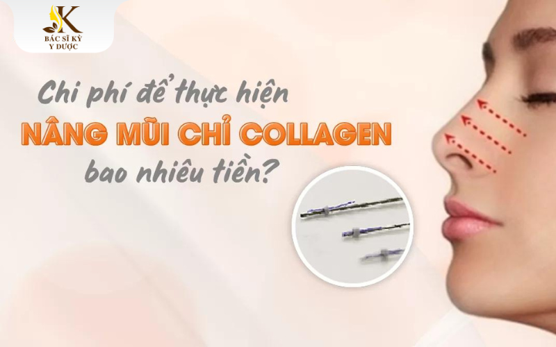 Nâng mũi chỉ Collagen bao nhiêu tiền