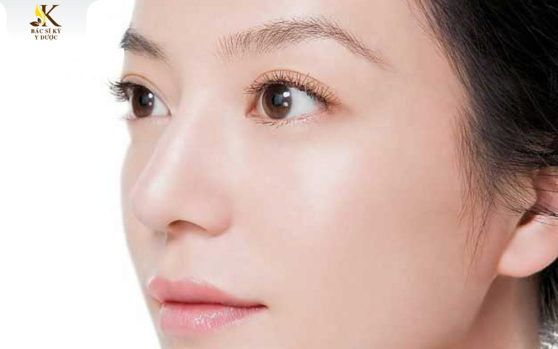 nâng mũi chỉ collagen bao lâu thì hết sưng