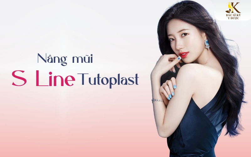 Nâng mũi S Line Tutoplast