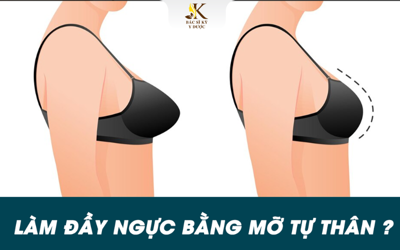 Nâng ngực