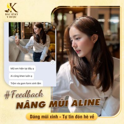 Nâng mũi cao tây tại Bác sĩ Kỳ Y Dược