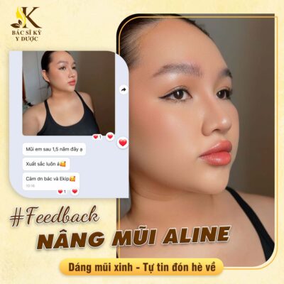 Nâng mũi cao tây tại Bác sĩ Kỳ Y Dược giúp tạo dáng mũi chuẩn tỷ lệ