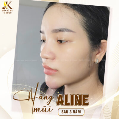 nâng mũi ở đâu đẹp nhất sài gòn