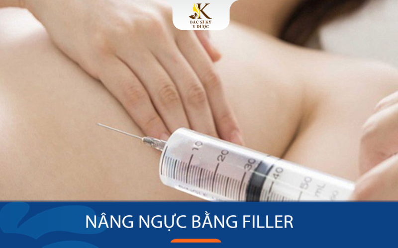 Nâng ngực bằng filler