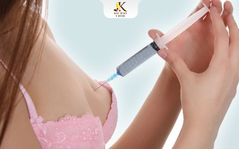 Có nên nâng ngực bằng filler không