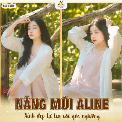 Nâng mũi xong bị thấp lại? Kết quả sau khi Nâng mũi Aline tại Bác sĩ Kỳ Y Dược