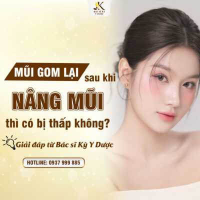 Nâng mũi gom lại có bị thấp không