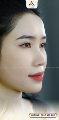 nâng mũi ở đâu đẹp nhất sài gòn