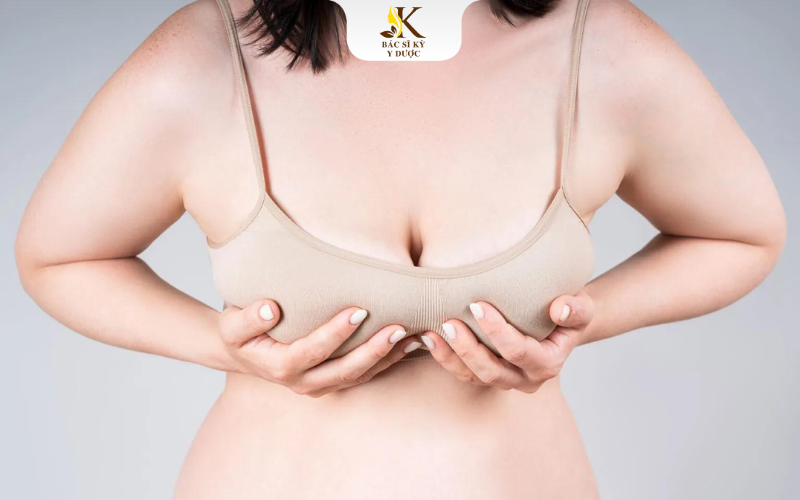 Chi phí nâng ngực chảy xệ