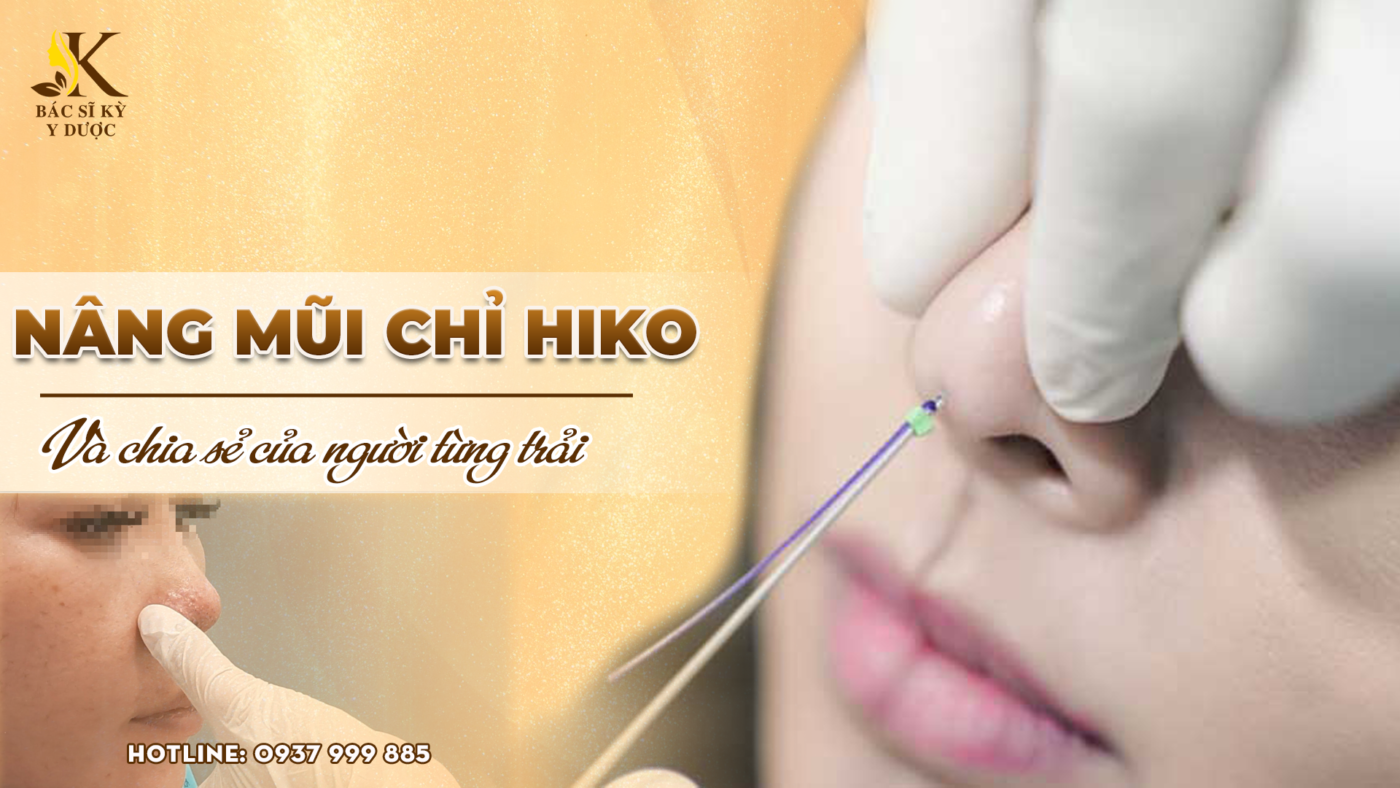 Nâng mũi chỉ Hiko